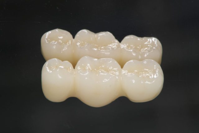 zirconia crown